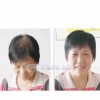 蘭州提供專業(yè)的隱形補(bǔ)發(fā)|蘭州哪家補(bǔ)發(fā)比較好